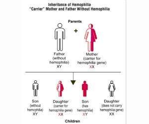 हेमोफीलिया/Haemophilia